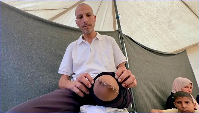 Investigace z BBC: Sufian Abu Salah uvedl, že byl v izraelské vazbě surově zbit a bylo mu odepřeno ošetření drobného zranění na noze